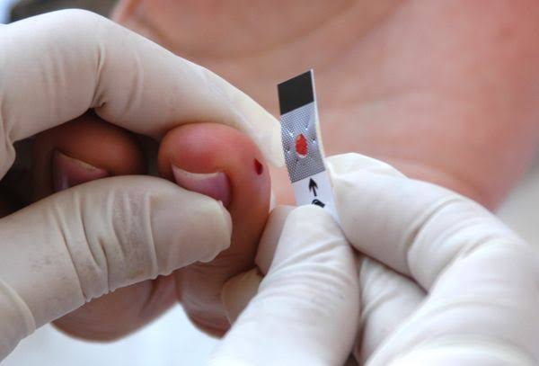 Saúde: Arena de Verão Promove Testes Rápidos Contra Hepatites Virais